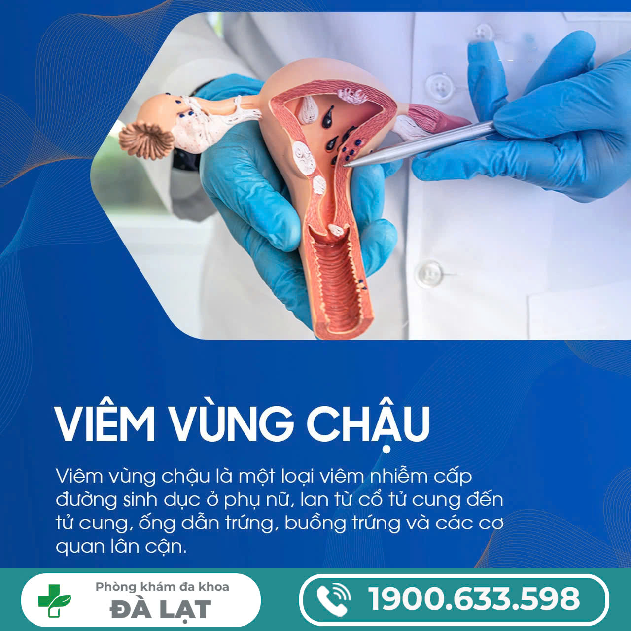 Hình ảnh minh họa